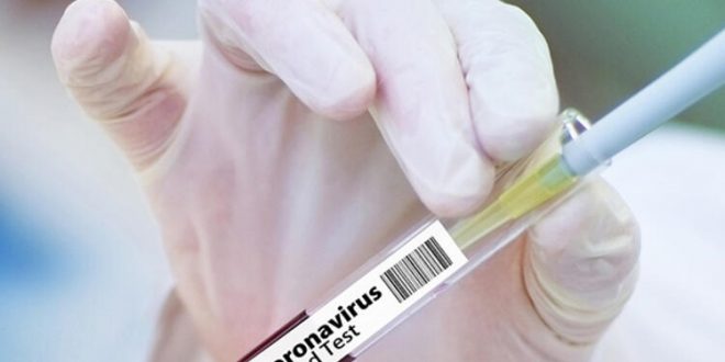 Brezilya'da son 24 saatte koronavirüs 115 can aldı