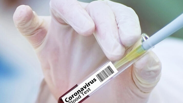 brezilya da son 24 saatte koronavirus 115 can aldi 01