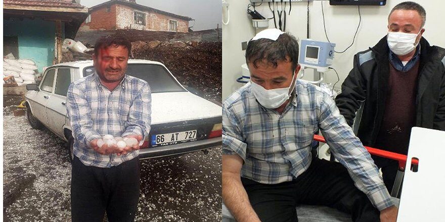 Yozgat’ta ceviz büyüklüğünde dolu!
