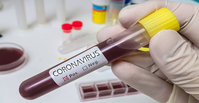30 mayis turkiye koronavirus tablosu 01
