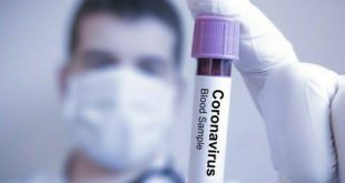 31 Temmuz Türkiye koronavirüs tablosu