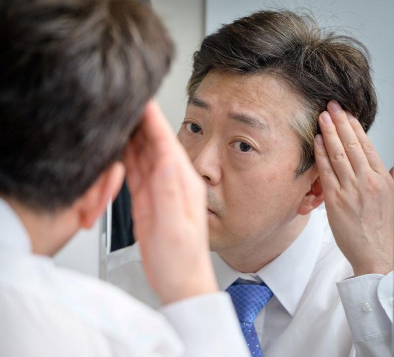 Güney Kore'de tuhaf seçim vaadi; kellere bedava saç!