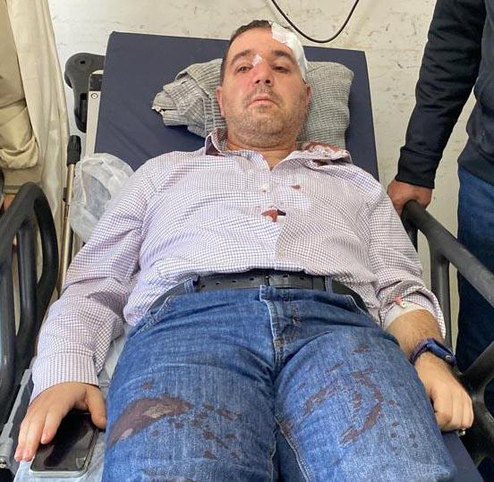 19 yaşındaki genç, doktorun burnunu kırdı!