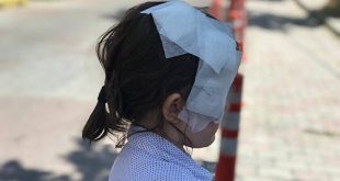 Bir pitbull dehşeti daha! 6 yaşındaki çocuk ölümden döndü