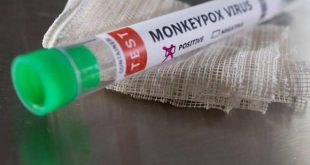 ABD ordusunda ilk maymun çiçeği vakası görüldü!