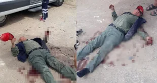 Sokak köpeklerin saldırısına uğrayan yaşlı adamın kolundaki damar parçalandı