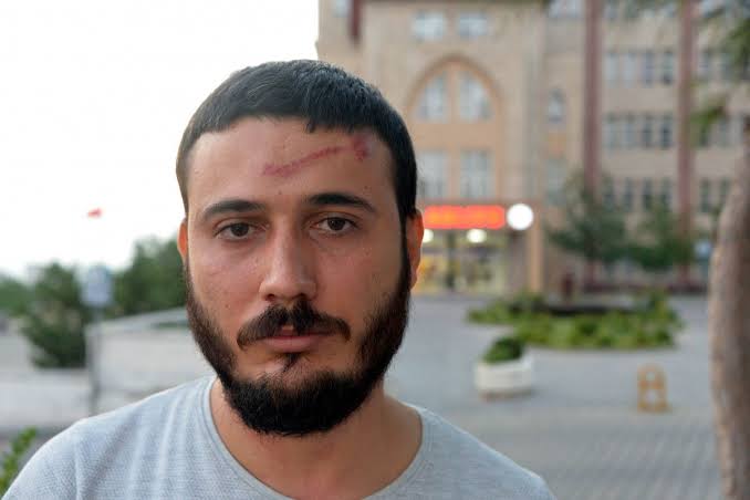 Devre mülk kirasını almak istediler, darp iddiasıyla şikayetçi oldular