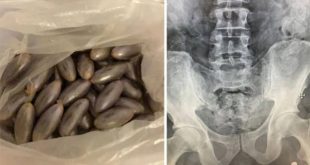 Faslı yolcunun midesinden 100 kapsül uyuşturucu çıktı