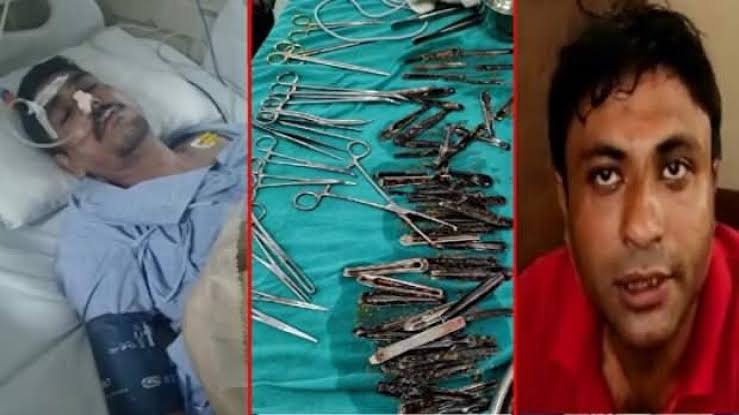 ‘Karnım ağrıyor’ diye hastaneye gitti, midesinden 63 tane kaşık çıktı!