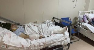 Yaşlı kadın pitbull saldırısına uğradı! Ayağını kaybetme riski var, köpek sahipleri ise serbest