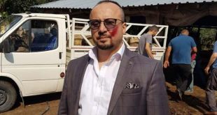 Avukatı ısırmanın cezası 4 yıla çıkarıldı!