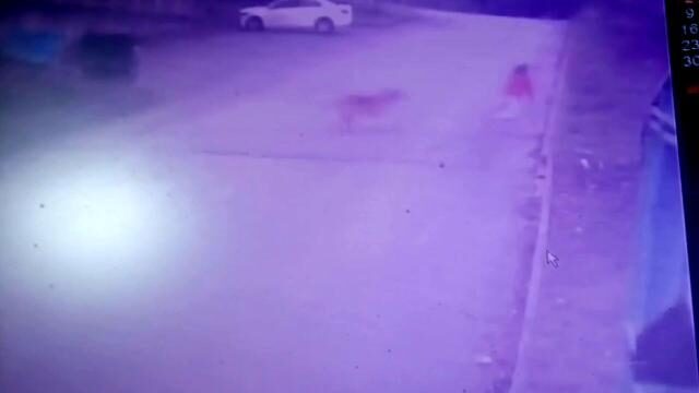 Sakarya’da ekmek almaya giden çocuk köpek saldırısına uğradı
