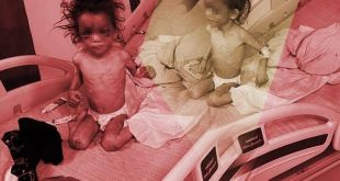 Gaziantep'te anne şiddeti! 5 yaşındaki kızını aç bırakmış