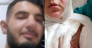 Üvey annesine kezzap ile saldırdı!