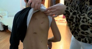 10 yaşındaki çocuk köpeklerin saldırısından servis şoförü sayesinde kurtuldu