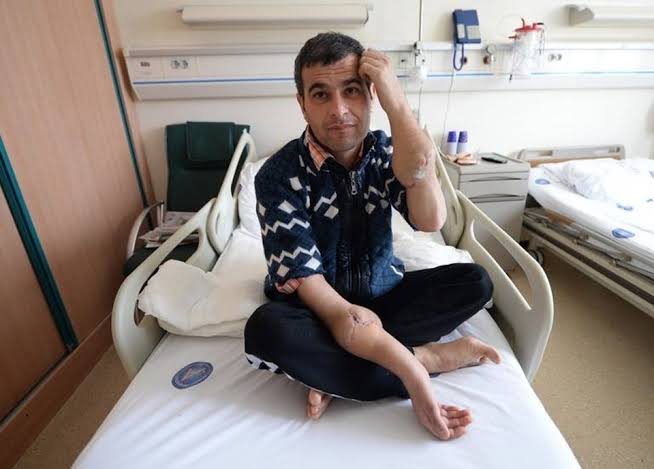 Çift kol nakli yapılmıştı, depremde yaşamını yitirdi!
