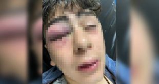 14 yaşındaki çocuğa polis işkencesine soruşturma!