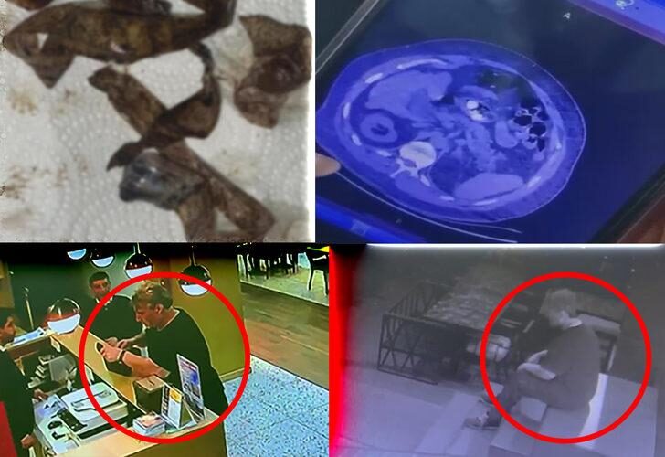 Midesinde taşıdığı uyuşturucu kapsülleri patlayan adam öldü!