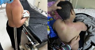 CHP'liler 10 yaşındaki çocuğa kaynar çay fırlattı!