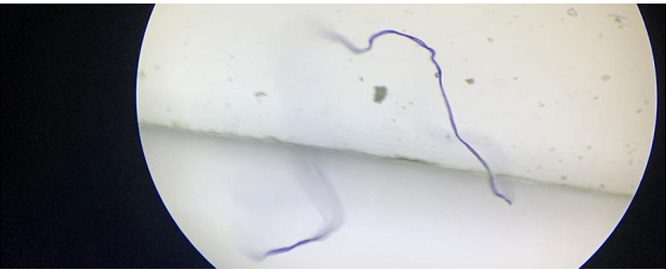 Covid-19 aşısının ölümcül madde varlığı Pfizer belgelerinde!