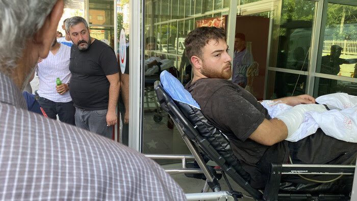 Elini kıyma makinesine kaptırdı, 3 parmağı parçalandı