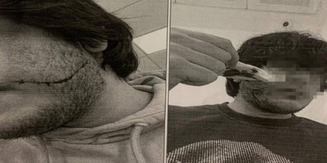 O partinin adı karışmıştı; ‘Irkçı’ saldırının ses kayıtları ortaya çıktı