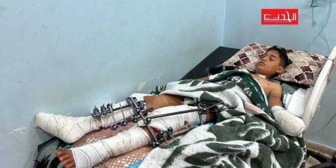 Alçak Siyonist plan; açlık çeken çocuklara bombalı konserveler!