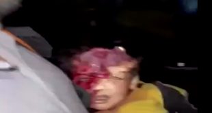 Müslümanlar bu görüntülere sessiz! Masum çocuğun dehşet verici ölümü!