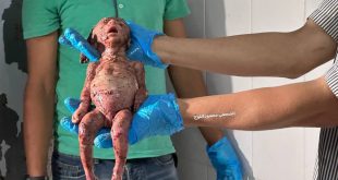 Kör olan görsün, sağır olan duysun! Anne karnında şehit oldu