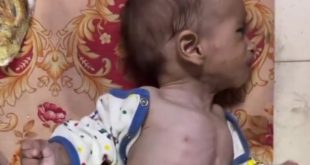 İsrail kuzeyde yeniden açlık kartını oynuyor!