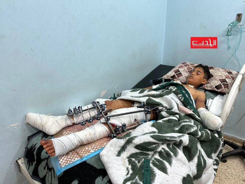 Alçak Siyonist plan; açlık çeken çocuklara bombalı konserveler!