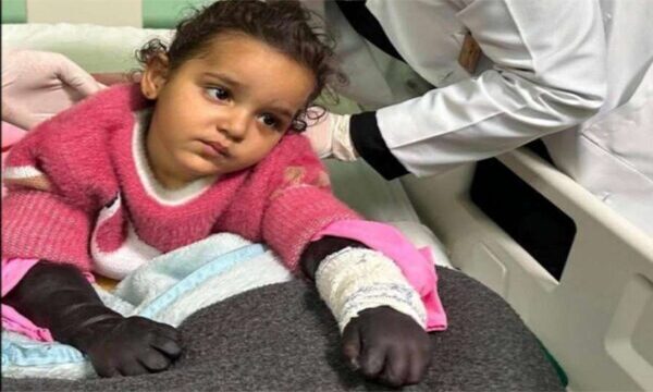 Gazzeli küçük kız ölümle savaşıyor: Yardım gelmezse uzuvları kesilecek!