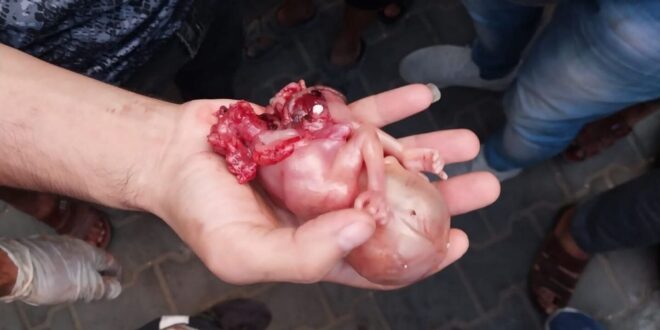 Ekran görüntüsü 2025 03 23 064804