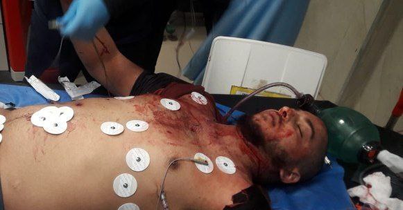 IMG 20250311 061031 856 IMG 20250311 061031 856