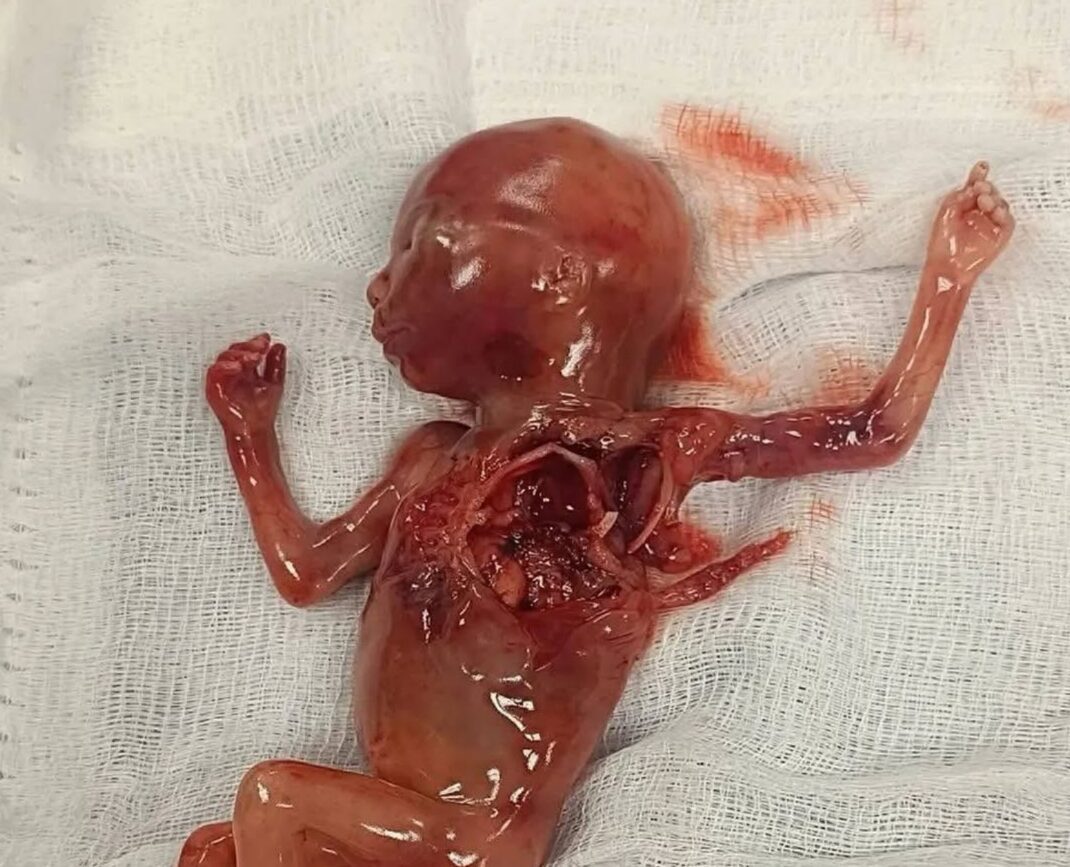 Ekran görüntüsü 2025 04 18 020145 Ekran görüntüsü 2025 04 18 020145