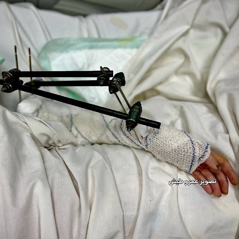 5219954001901120927 120 5219954001901120927 120