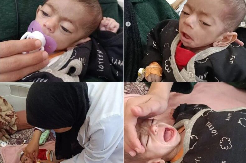 Ailesi yardım talep etmişti: Gazzeli Canan bebek açlığa yenik düştü!