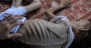 5792029373551986449 121