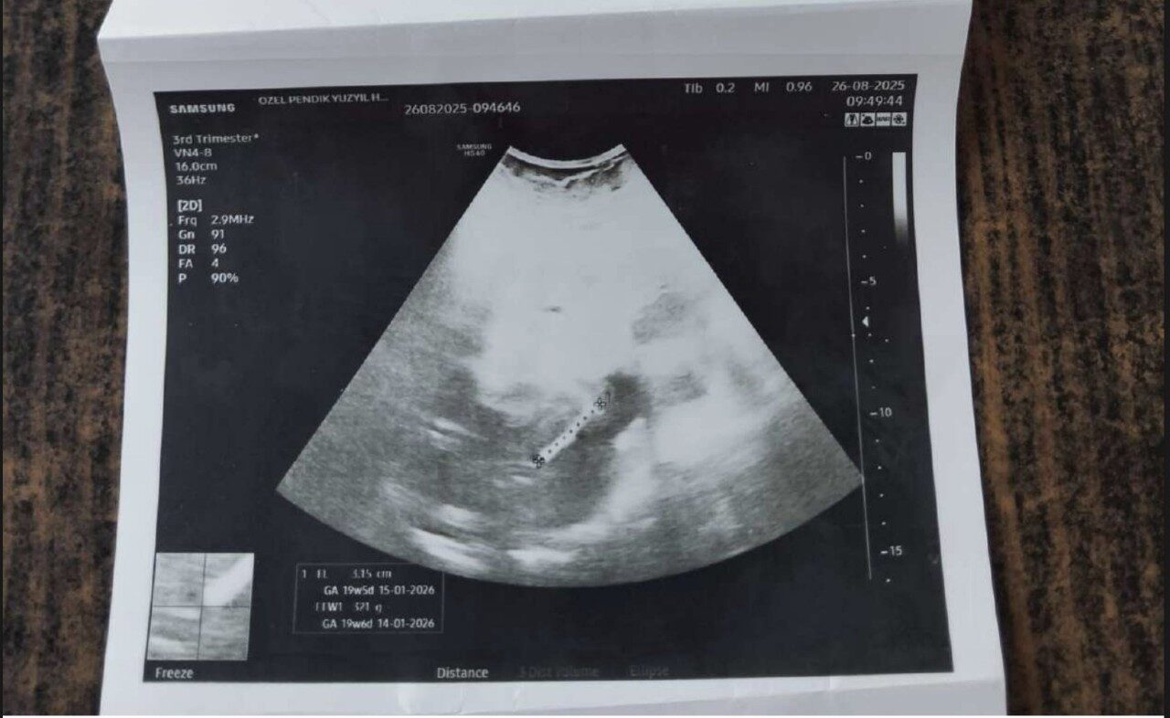 image 2025 11 25 17 53 39