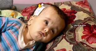 5929332752090074306 121