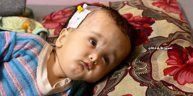 5929332752090074306 121