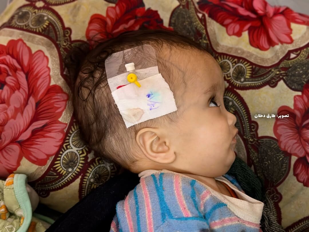 5929332752090074308 121 5929332752090074308 121