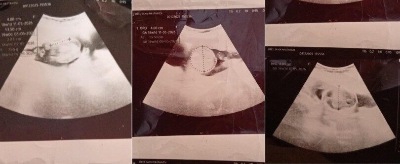 image 2026 01 14 22 56 40