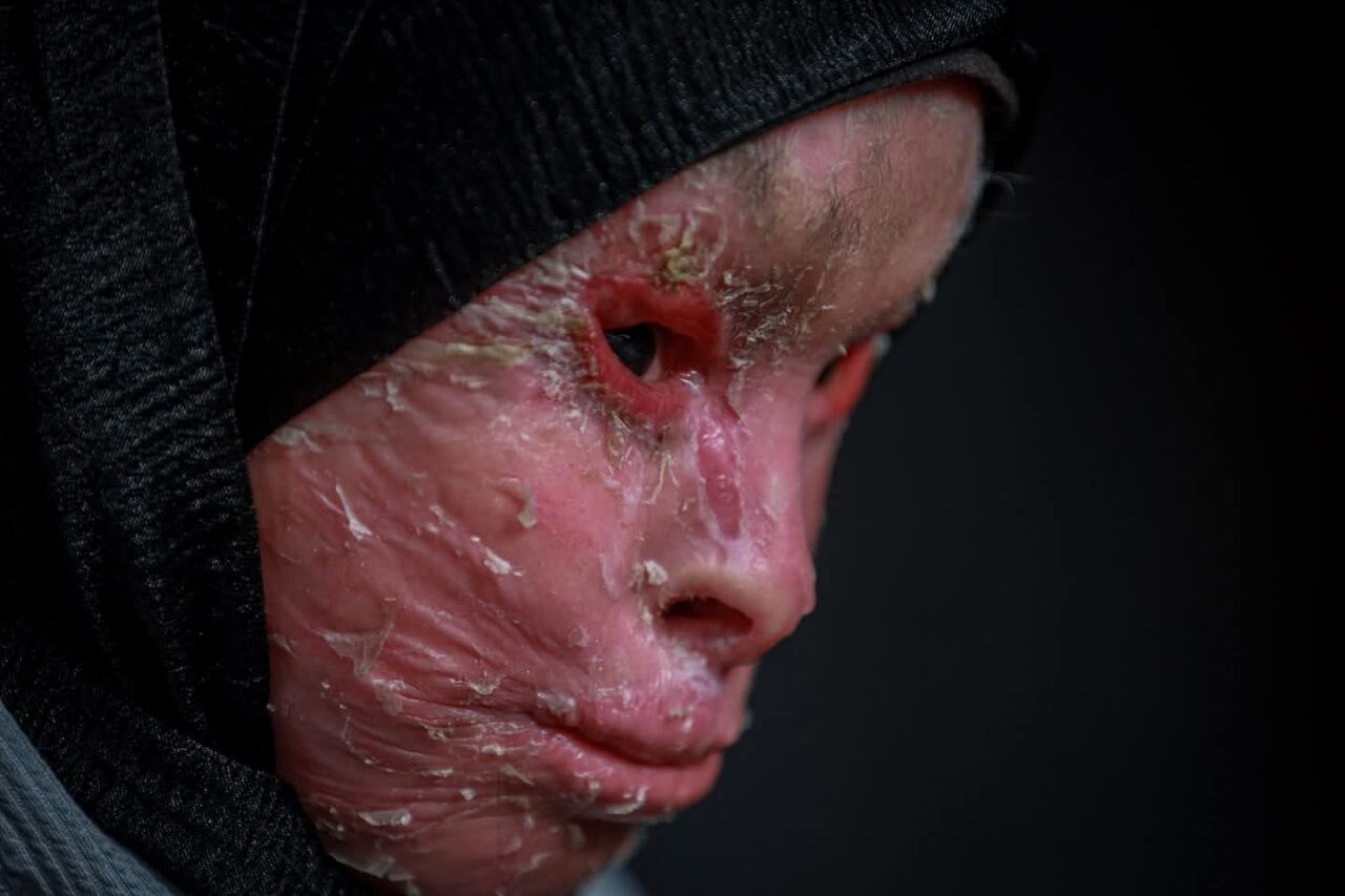 5997022308553395001 121 5997022308553395001 121