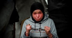 5997022308553394998 121