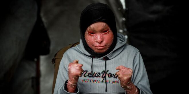 5997022308553394998 121