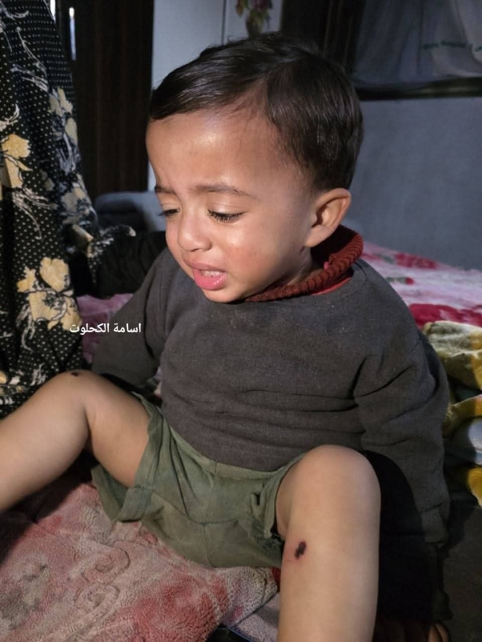 5332597537946407969 121