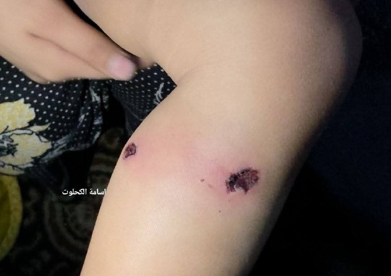 5332597537946407967 120