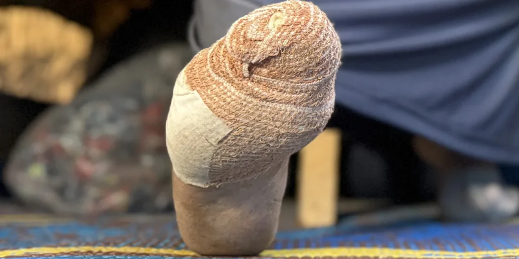Çadırlarda kemirgen terörü; fareler Gazzelileri kemiriyor!