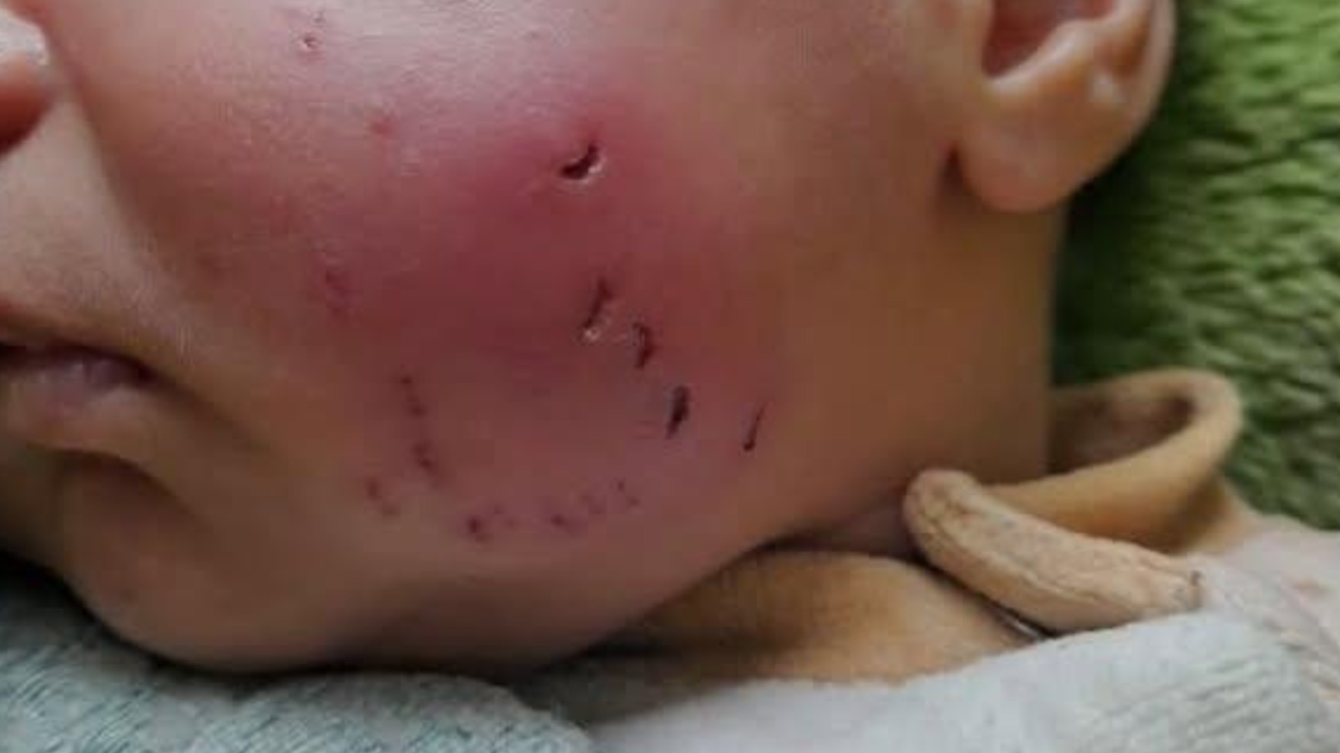 rodent marks mee 2026 rodent marks mee 2026